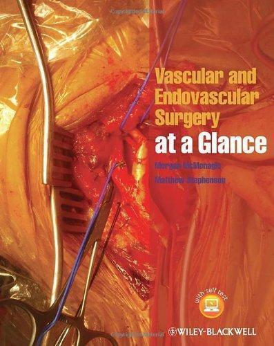 Vascular And Endovascular Surgery At A Glance