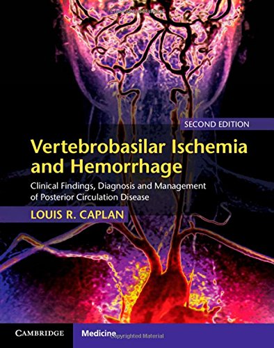 Vertebrobasilar Ischemia and Hemorrhage (Clinical Findings, Diagnosis and Management of Posterior Circulation Disease) 2-edition